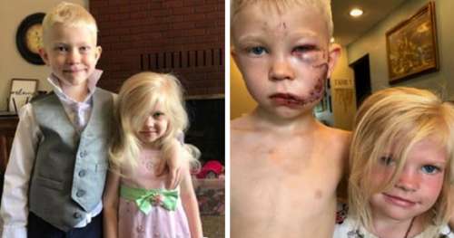 Un garçon de 6 ans considéré comme un héros pour avoir sauvé sa petite sœur de l’attaque d’un chien