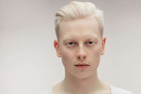 Les sœurs albinos, à quoi elles ressemblent maintenant