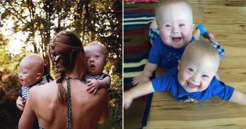 Une mère veut faire adopter des jumeaux trisomiques, mais change d’avis au troisième trimestre