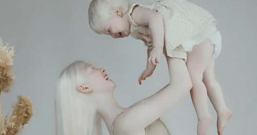 Des sœurs albinos nées à 12 ans d’écart deviennent des sensations de mannequinat
