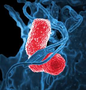 Découverte majeure : une bactérie intestinale impliquée dans la progression de maladies auto-immunes