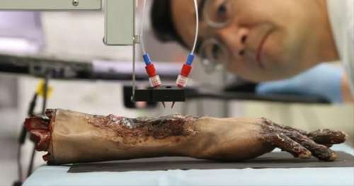 Cette bio-imprimante 3D reconstitue de la peau directement dans la plaie des blessés