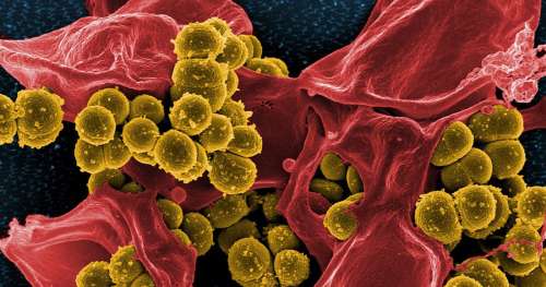 Et si les plantes étaient la solution contre les superbactéries résistantes aux antibiotiques ?