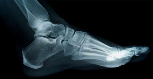 Le saviez-vous ? 25 % des os de notre corps se trouvent dans nos pieds