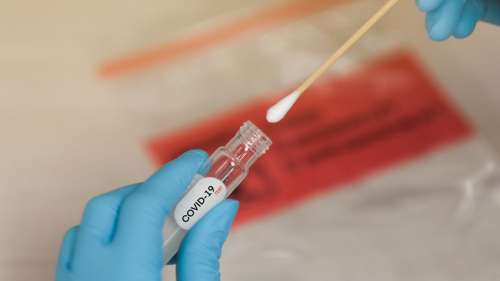 Les tests sérologiques indiqueraient 50 fois plus de cas de Covid-19 que les chiffres officiels