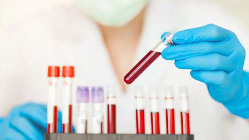 Ce nouveau test sanguin détecte plus de 50 types de cancer, certains avant les premiers symptômes