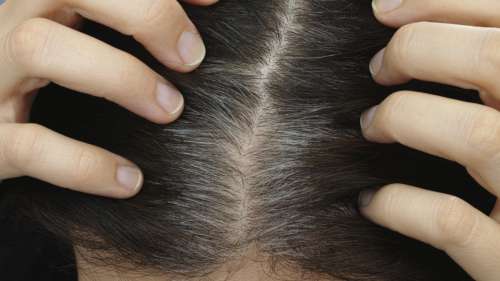 Une étude sur le stress montre que les cheveux grisonnants sont réversibles