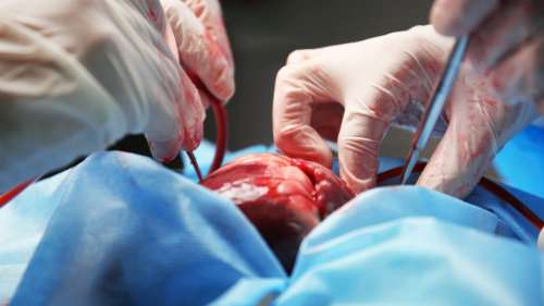 Le premier cœur de porc greffé sur un patient humain était porteur d’un virus animal