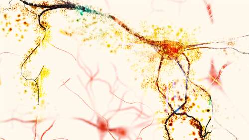 Les chercheurs ont une nouvelle théorie sur l’origine de la maladie d’Alzheimer