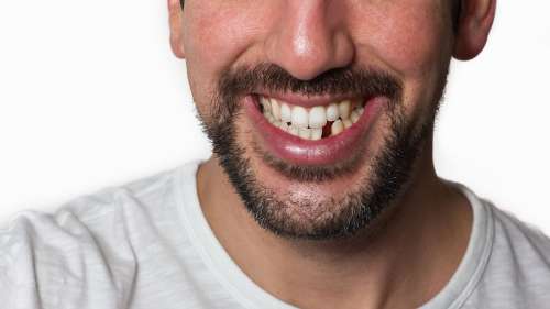 Les scientifiques peuvent-ils faire repousser des dents ?