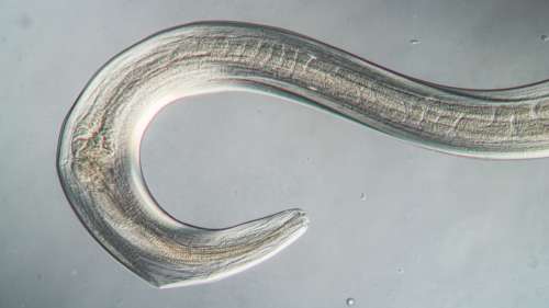 Première mondiale : un ver parasite de 8 centimètres extrait vivant du cerveau d’une femme