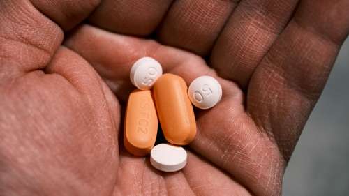 Les médicaments contre le VIH réduisent de 72 % le risque de sclérose en plaques