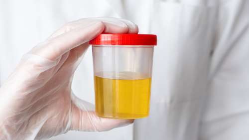 Pourquoi notre urine est-elle jaune ? Les scientifiques ont enfin la réponse
