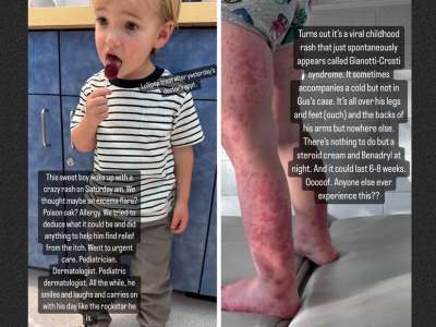 Mandy Moore révèle que son fils de 2 ans, Gus, est atteint du syndrome de Gianotti-Crosti