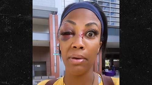 L’olympienne américaine Kim Glass attaquée par un sans-abri à Los Angeles, blessures horribles