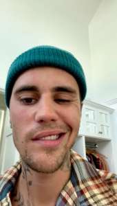 Justin Bieber partage une mise à jour sur la mobilité faciale après le diagnostic du syndrome de Ramsay Hunt