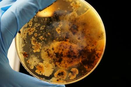 Des médecins sonnent l’alerte face à une bactérie “mangeuse de chair”