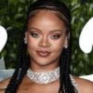 Rihanna sans maquillage : elle assume un immense bouton sur son visage