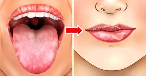 Pourquoi les lèvres s’assèchent (et quelques astuces pour éviter ça)