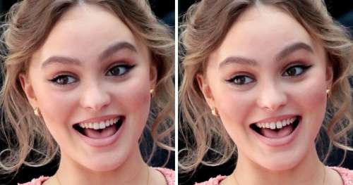 15 Photos de célébrités françaises qui montrent comment un petit changement de dents peut transformer le visage