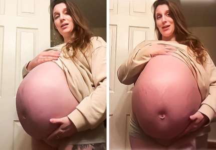 L’énorme ventre d’une femme enceinte donne l’impression qu’elle attend huit bébés
