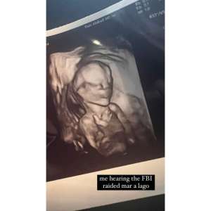 Chrissy Teigen, enceinte, partage sa première photo échographique