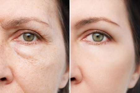 L’hydratant IT Cosmetics traite 10 signes du vieillissement – 30% de réduction !